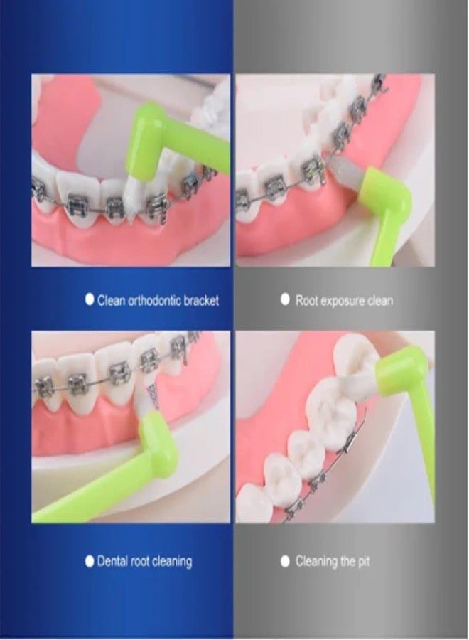 Digital Shoppy Wisdom tooth socket cleaning orthodontic toothbrush,Green, (1 pair) - Image 2
